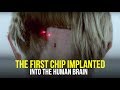 "This Could Be a Tragedy For Humanity" | The First Brain Chip Implant