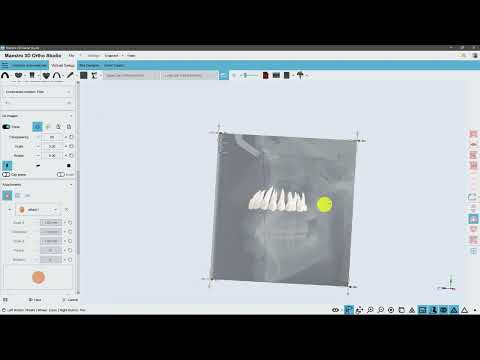 Virtual Setup | 2D Images (lateral radiography, reference arcs)