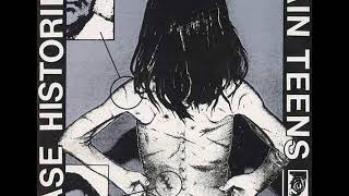 Pain Teens  -  Puzzling Diagnoses