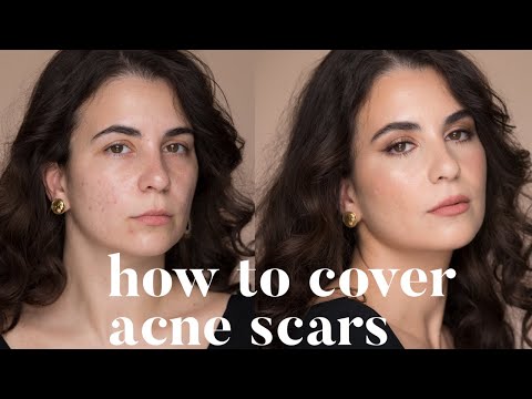 HOW TO COVER ACNE SCARS | ALI ANDREEA