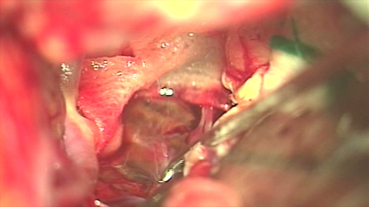 Arthur Maynart Pereira Oliveira-3