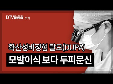 의느님답변????ㅣ의느님답변 71회 확산성 비정형 탈모(DUPA)의 치료 방법은 두피문신?