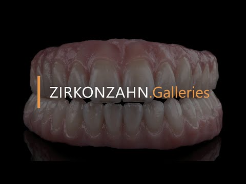 Digitaler Workflow: implantatgetragene Komplettversorgung aus Prettau® 2 | Zirkonzahn.Galleries