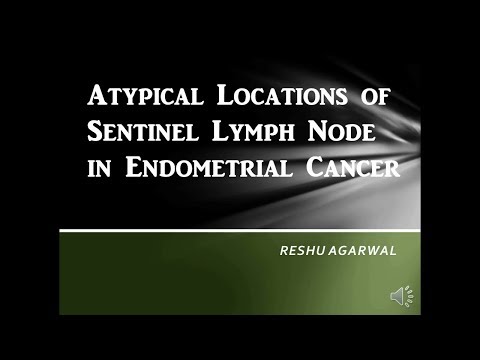 Atypical Locations of Sentinel Lymph Nodes in Endometrial Cancer