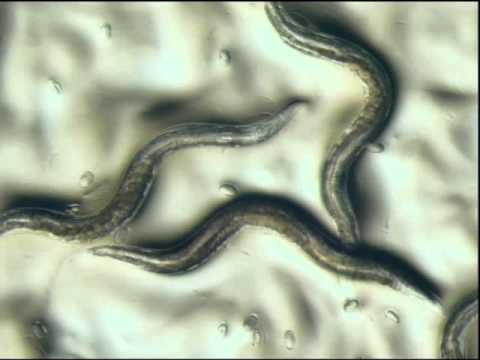 Interventions in Aging and the Caenorhabditis Intervention Aging Program - Dr. Gordon Lithgow