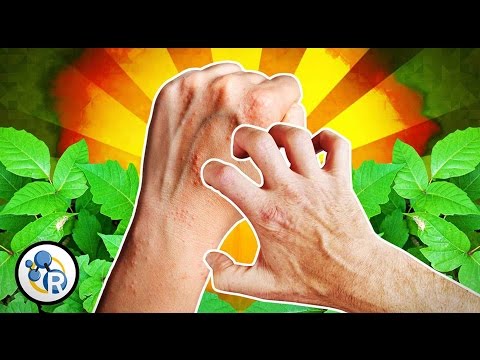 The Chemistry of Poison Ivy