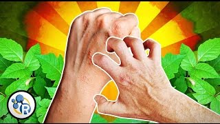 The Chemistry of Poison Ivy