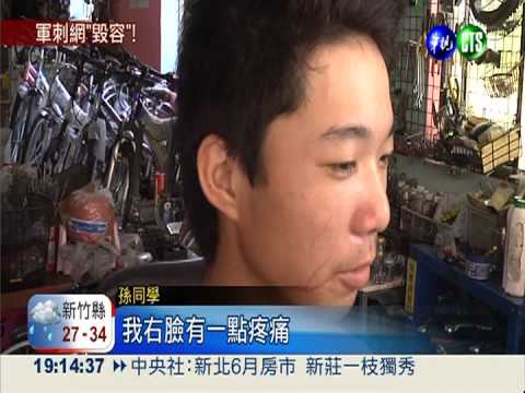 花防部鐵網勾人 高中生摔車毀容!