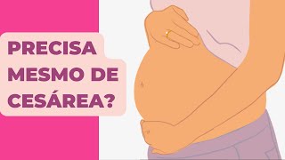 6 INDICAÇÕES REAIS DE CESÁREA