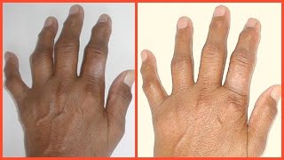 IN JUST MINUTES, GET SOFT CLEAR WRINKLE FREE HANDS, HOW TO GET YOUNGER LOOKING HANDS, Khichi Beauty