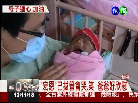 生命奇蹟! 男嬰已拔管會哭喊