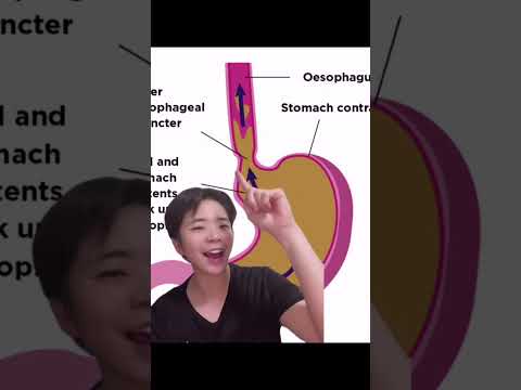 Acid reflux, don't sleep in this position. #Doctor Nui #Surgeon
