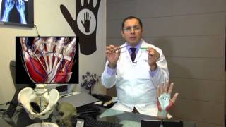 LESIONES EN LOS TENDONES/DOCTOR GABRIEL RAMIREZ LOZANO-CIRUGÍA DE MANO