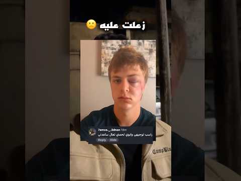 والده بضربه وانا ساعدته 🙂