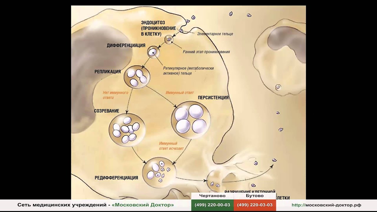 Хламидиоз у мужчин симптомы фото
