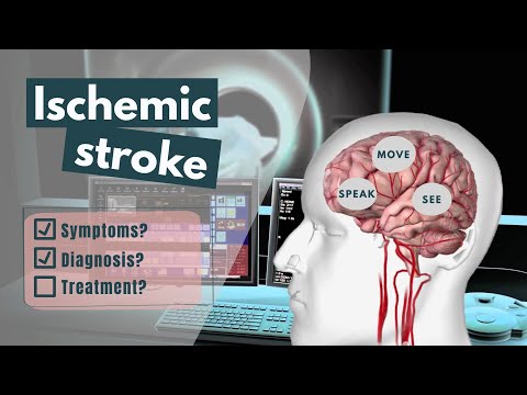 Ischemic Stroke Animation | Symptoms, diagnosis, treatment & prognosis