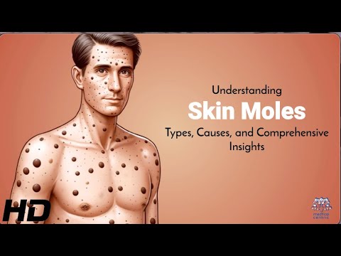 Skin Moles Demystified: A Complete Guide to Types and Causes