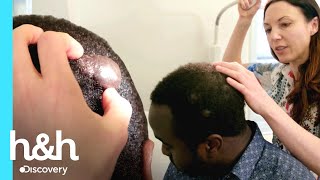 Remoción de queloides de su cabeza con láser | Clínica de la piel | Discovery H&H