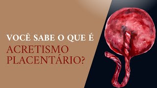 Você sabe o que é ACRETISMO PLACENTÁRIO?