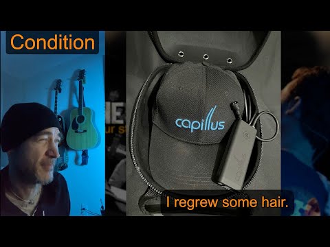 ReneRafael.com/eBay - Capillus 82 Laser Hair Growth Therapy Cap