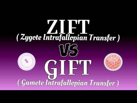 DIFFERENCE BETWEEN ZIFT AND GIFT