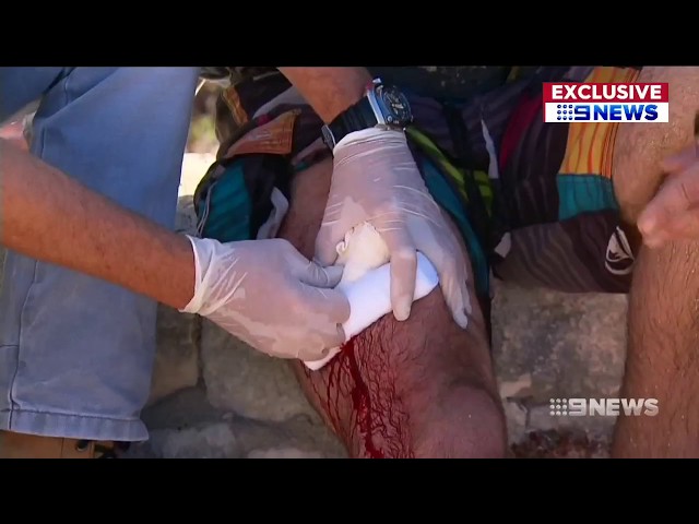 Shark Attack | 9 News Perth