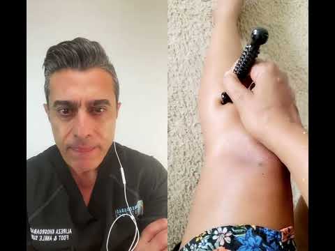 Gout treatment