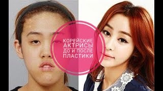 Корейские актрисы ДО И ПОСЛЕ ПЛАСТИКИ