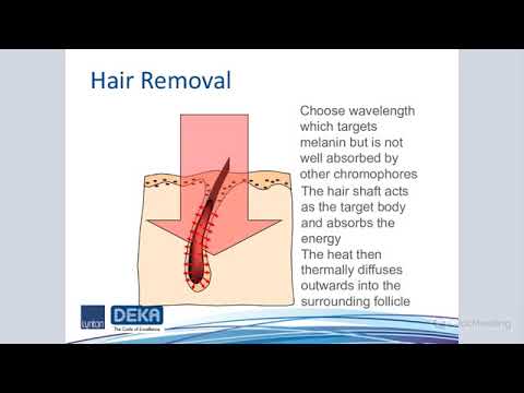 Lynton Webinar. Advancements in Laser Hair Removal. Dr Sam Hills, Customer Service Director