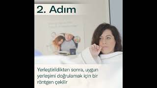 Yutulabilir mide balonu - Kırıkkale Özel Yaşam Hastanesi