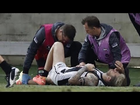 Jeremy Howe’s sickening injury
