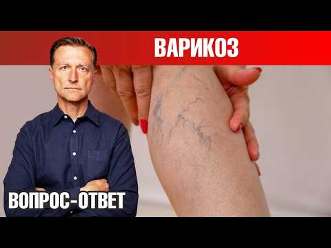 Как избавиться от варикоза 👉 лучший способ и профилактика Как избавиться от варикоза 👉 лучший способ и профилактика