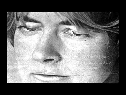 download lagu mp3 mp4 Henry Tonks Art And Surgery, download lagu Henry Tonks Art And Surgery gratis, unduh video klip Henry Tonks Art And Surgery