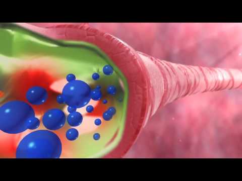 What Happens to Your Airways During Asthma? | 3D Animation Explained