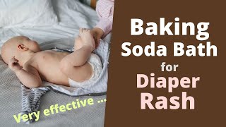 Baking Soda Bath for Diaper Rash - Will It Help?