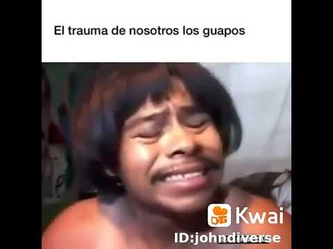 Chaparro 😂 me duele la cara de ser tan guapo.. 😂 😂 😂 😂
