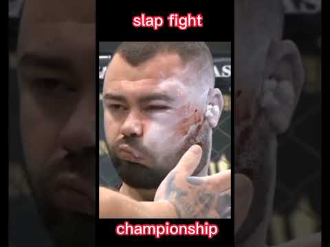 Swelling Face😢 SLAP FIGHT CHAMPIONSHIP
