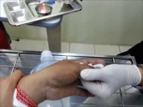 Mumie ในการรักษาโรคสะเก็ดเงิน Sophora จาก neurodermatitis