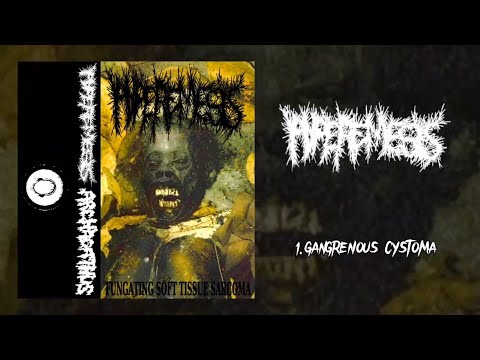 Hyperemesis / Archagathus FULL split (2015 Goregrind)