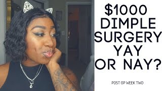 $1000 Dimple Surgery | yay or nay?