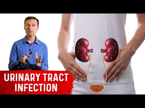 Top Remedies for a UTI (Urinary Tract Infection: Updated)