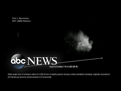 人間のくしゃみを研究している科学者が新たな警告を発した｜WNT (New warning from scientists studying human sneeze | WNT)