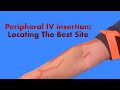 Peripheral IV Insertion: Locating the Best Site