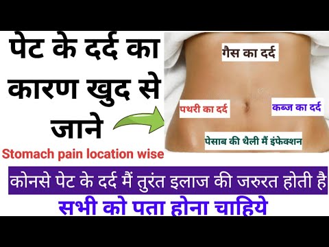 पेट के किस part मैं किस वजह से pain होता है || Acute abdomen || Stomach pain causes