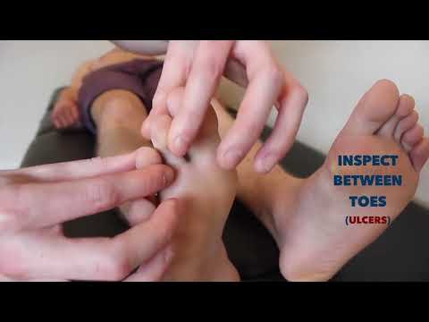 Peripheral Vascular Examination   OSCE Guide New Version