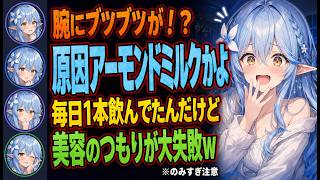 腕の発疹に気づいたラミィ→アーモンドミルクを1日1本飲んでた件ｗ【ホロライブ切り抜き雪花ラミィ】