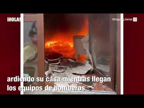 MIGUEL HERRAN SUFRE INCENDIO MIENTRAS DORMÍA 🥺