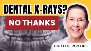 Do You Need Dental X-Rays?