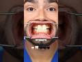 Tooth Shape Meaning