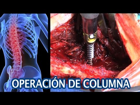 Vivo inflamación de las articulaciones saludables Complejo de supina osteocondrosis